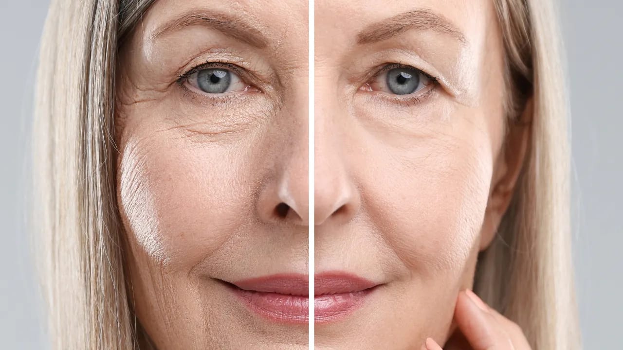 Skin rejuvenation anti-aging collagen red light therapy